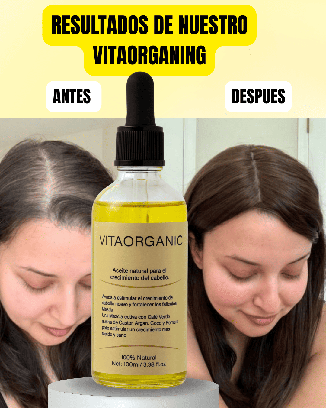 VITAORGANIC – Aceite Natural para el Crecimiento del Cabello