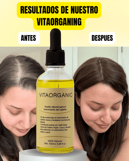 VITAORGANIC – Aceite Natural para el Crecimiento del Cabello